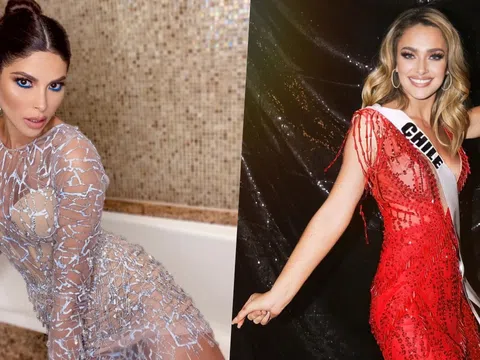 Người đẹp Colombia tố bị đại diện Chile đốt váy ở Miss Universe